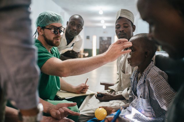 Adamu raakte geïnfecteerd met noma, Nigeria | Artsen zonder Grenzen
