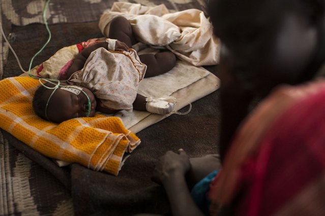 De 4 maanden oude Nyawal Mabil wordt behandeld in het ziekenhuis in Lietchuor , Ethiopië