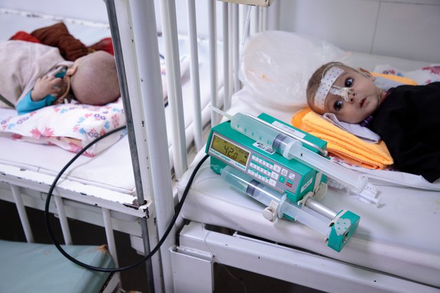 kinderen opgenomen ziekenhuis ondervoeding