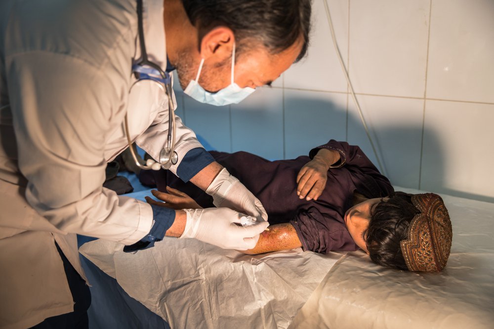 De 8-jarige Qadratullah wordt behandeld aan het abces op zijn arm in het Boost-ziekenhuis in Afghanistan.
