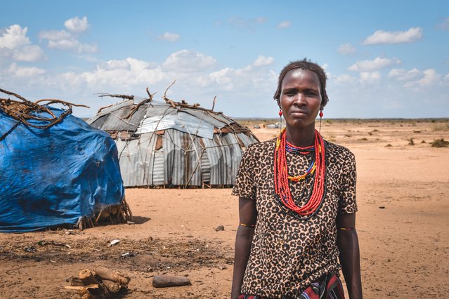 Telite is opgenomen met ondervoeding in onze kliniek in Kenia.