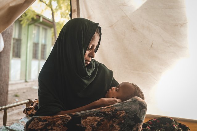 Voedingskliniek van Artsen zonder Grenzen in Ethiopië