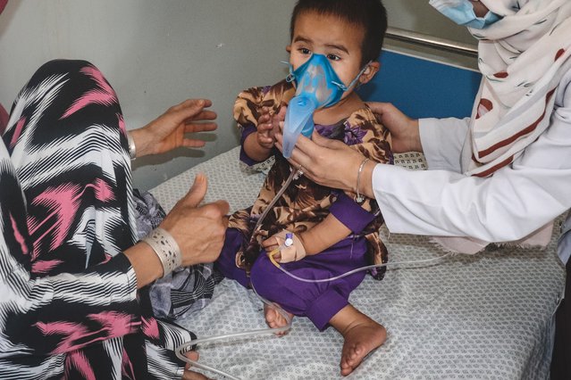 De twee-jarige Rihana wordt behandeld door een Artsen zonder Grenzen arts, voor mazelen in het ziekenhuis in Kunduz, Afghanistan.