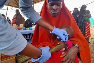 somalie ondervoeding arm van baby opmeten