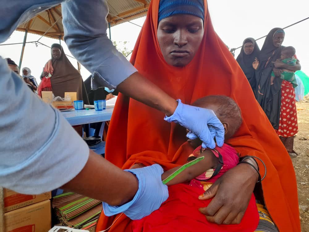 somalie ondervoeding arm van baby opmeten