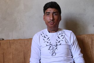 Abdulbari patiënten in het Atmeh ziekenhuis in Syrië