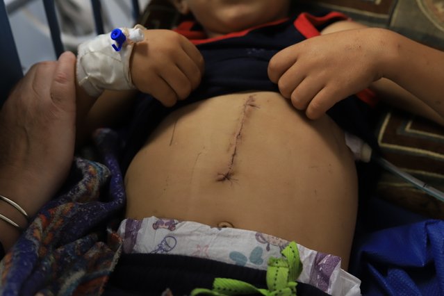 onze teams in gaza zien enorm veel verwondingen bij kinderen