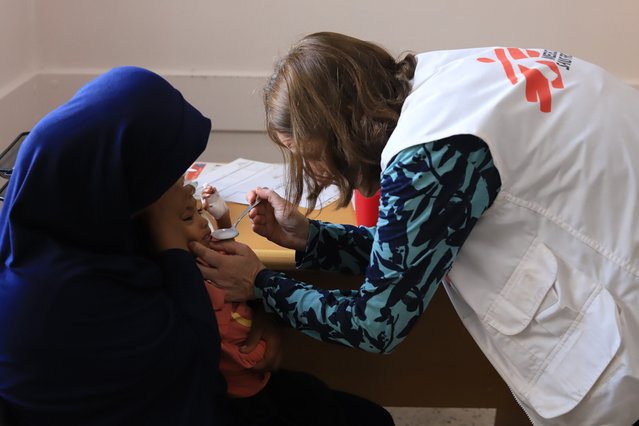 arts buigt zich over kind dat lijdt aan acute ondervoeding in gaza