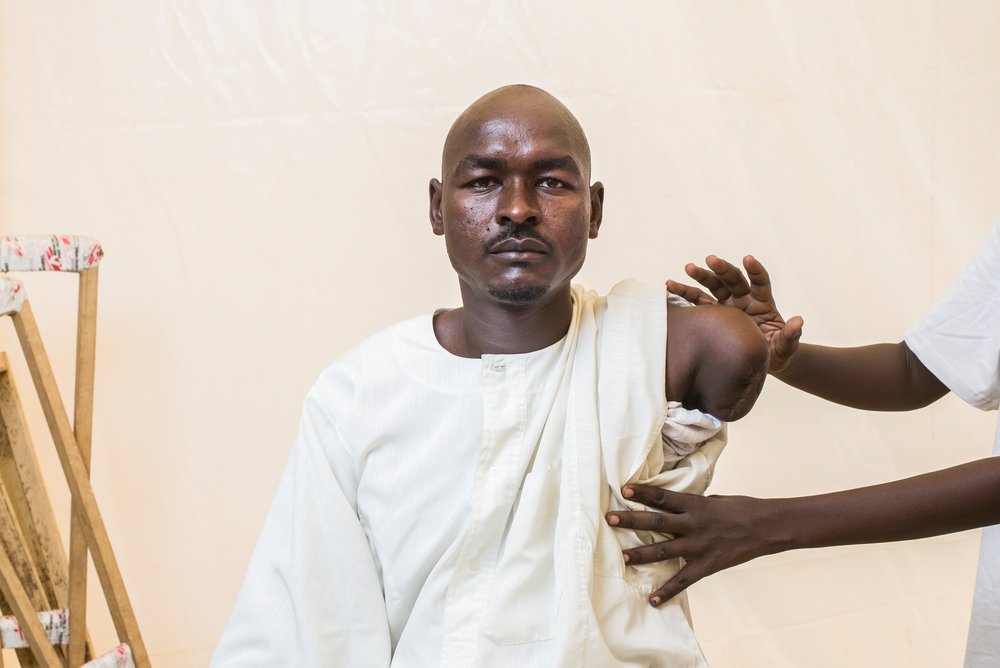 Adam (32) moest zijn arm laten amputeren omdat hij te laat medische hulp kreeg nadat hij door een kogel werd geraakt. © Corentin Fohlen/Divergence