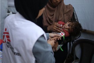 Ondervoed kind in Gaza