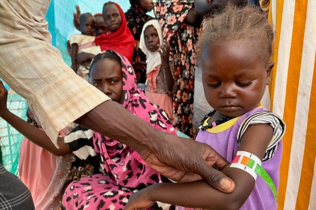meisje wordt gecheckt op ondervoeding