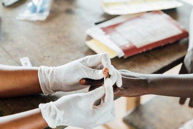 sierra leone baby malaria