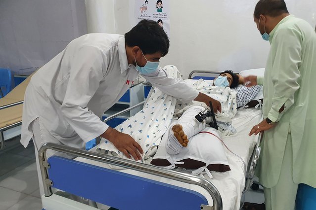 Deze patiënt is geraakt tijdens een bomexplosie. Hij ligt op de spoedeisende hulp in de kliniek voor zwaargewonden in Kunduz. © Stig Walravens/MSF