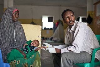 een kindje dat lijdt aan ondervoeding in Somalie