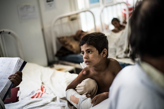 Een kind op de afdeling Orthopedie van het Boost-ziekenhuis in Lashkar Gah, Afghanistan.