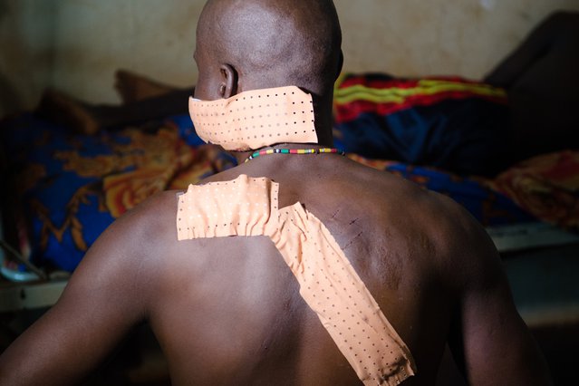 De verwondingen van een man in de Centraal Afrikaanse Republiek