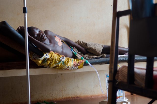 We behandelen Destin in ons ziekenhuis in Bangassou, Centraal Afrikaanse Republiek.