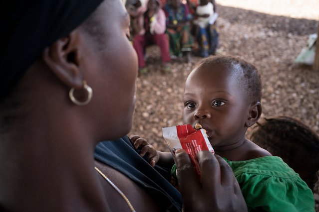 ondervoeding Oeganda moeder kind