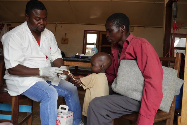 Arts Artsen zonder Grenzen behandelt een ondervoed kind in de Centraal Afrikaanse Republiek.