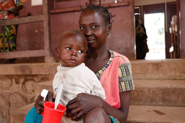 Een ondervoed kind drinkt speciale melk in voedingscentrum Artsen zonder Grenzen in de Centraal Afrikaanse Republiek.
