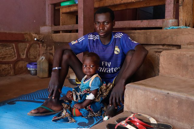 Een ondervoed jongetje met zijn vader in kliniek Artsen zonder Grenzen | Centraal Afrikaanse Republiek