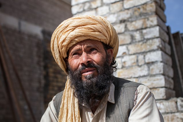 Cutaneous Leishmaniasis behandeling, Kuchlak, Pakistan | Artsen zonder Grenzen