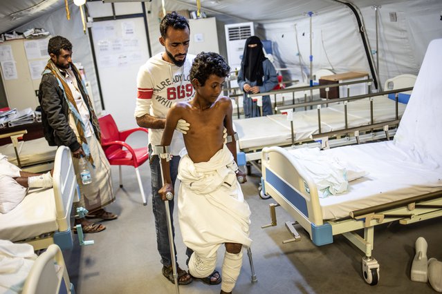 De 14-jarige Nasser doet oefeningen met onze fysiotherapeut Farouk in veldhospitaal Artsen zonder Grenzen in Jemen.