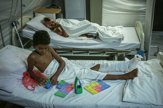 Patiënten in ziekenhuis Artsen zonder Grenzen in Mocha, Jemen.