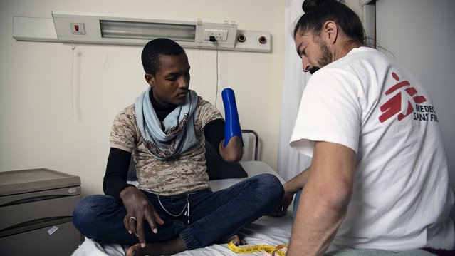 Behandeling reconstructie operatie in ziekenhuis Jordanië | Artsen zonder Grenzen