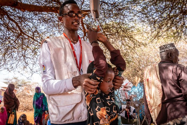 Kind met ondervoeding meten in mobiele kliniek Ethiopie | Artsen zonder Grenzen