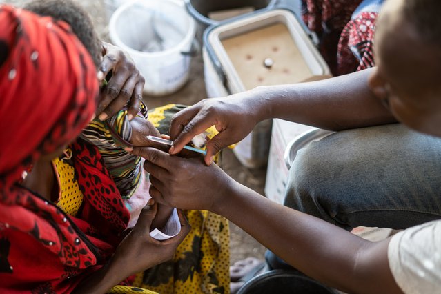 Tsjaad: bijna een miljoen kinderen gevaccineerd tegen mazelen