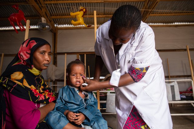 We behandelen een kind in Tsjaad voor de mazelen | Artsen zonder Grenzen