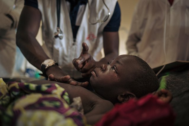 Foto: meisje is opgenomen voor behandeling voor mazelen door Artsen zonder Grenzen in DR Congo.