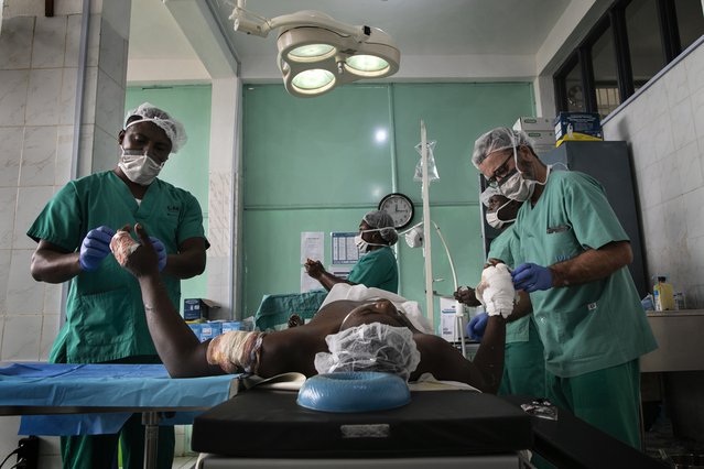Een man wordt behandeld aan zijn schotwonden in een van onze klinieken in west-Kameroen. ©Albert Masias