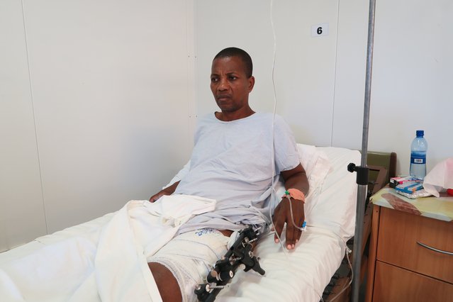 Een man met een beenbreuk in het Artsen zonder Grenzen traumacentrum in Port-au-Prince, Haïti.