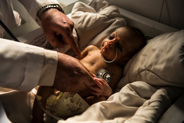 Een kleine patiënt in het Boost-ziekenhuis in Afghanistan