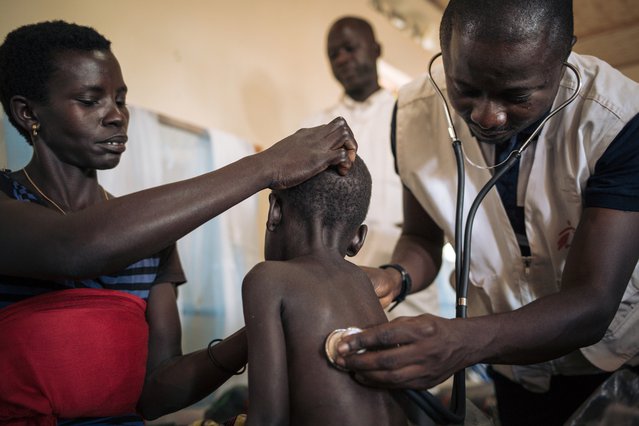 Foto: meisje wordt voor mazelen behandeld door Artsen zonder Grenzen in DR Congo.