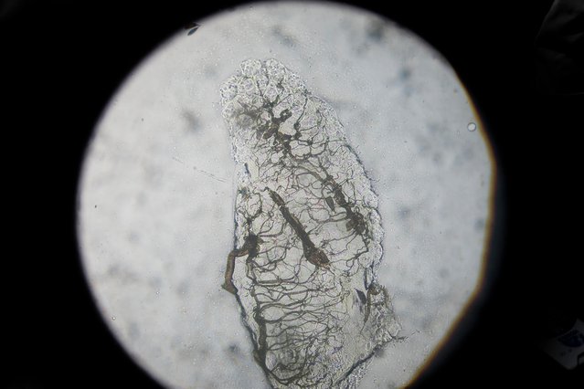 Microscopisch beeld van de eierstok van een Anopheles-mug
